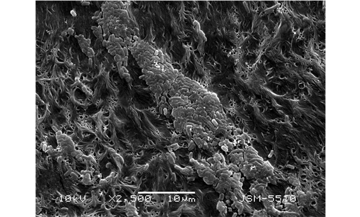 bakterii_700x700_fit_478b24840a